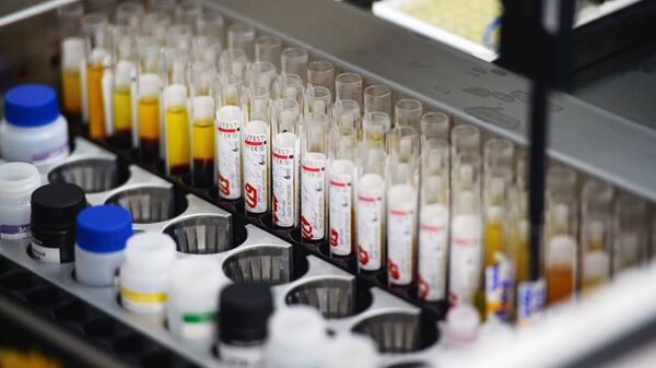 Immunoassay screening lab the blood is tested for infection (hepatitis, syphilis, HIV) on automatic equipment at the Novosibirsk blood donation center - Sputnik Africa