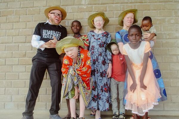 This photo was taken on January 1, 2022, in Ukerewe, where Sixmond Mdeka, a Tanzanian gospel reggae singer, preacher, and social advocate for disability and albinism awareness, organized a Christmas and New Year's party for marginalized groups, including people with albinism, the physically disabled, and the elderly, through his organization Disability Support Tanzania. - Sputnik Africa