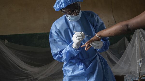 Atumisi Anaclet treats a sex worker with mpox on Sept. 4, 2024, in a hospital in Kamituga, in eastern Congo's South Kivu province, which is the epicenter of the world's latest outbreak of the disease.  - Sputnik Afrique